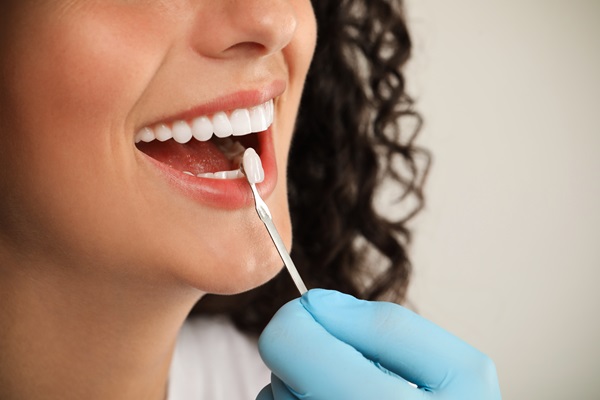 Top Reasons To Consider Dental Veneers For Your Teeth