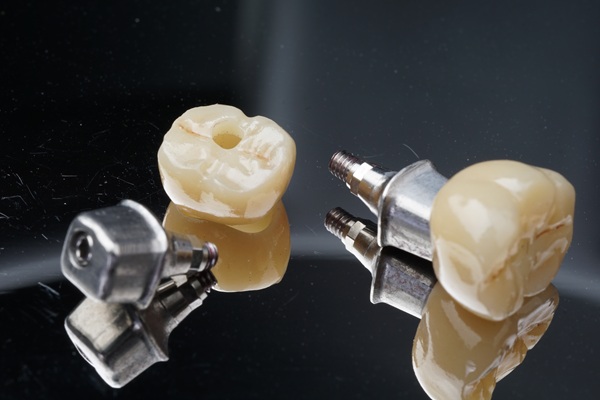 Dental Implant Crown Placement FAQs